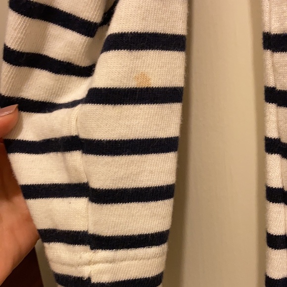 Gap dress xs small stain on arm - Picture 3 of 3